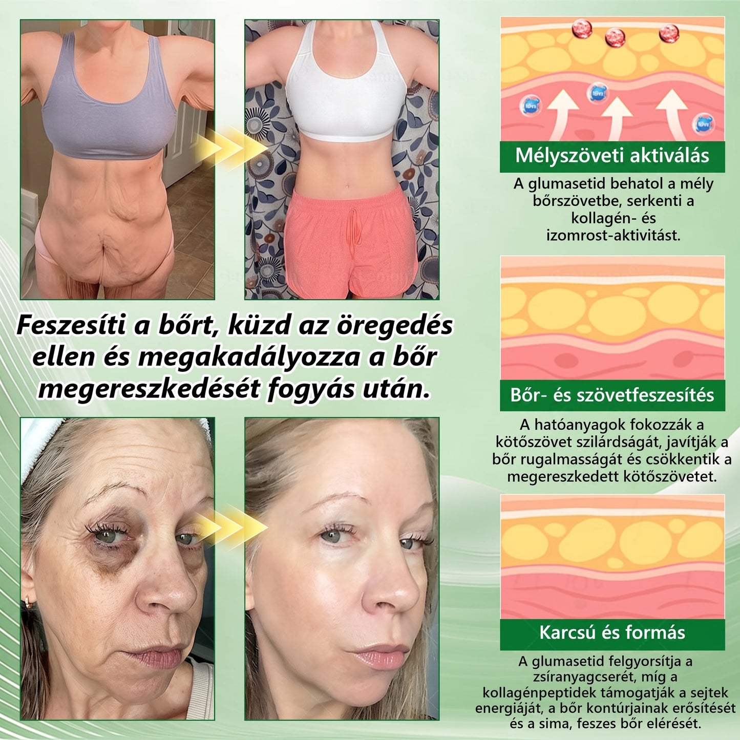 🌿Luxarise®Glumasetide 8az 1-ben Karcsu és Egeszséges Nano Mikrotus Tapasz (Napi 1alkalom – látható változásakár 7 nap alatt) ✅ Elhízásra,bőrfeszesítésre,cukorbetegségre, alvásiapnoéra, ízületekre stb HU🍀