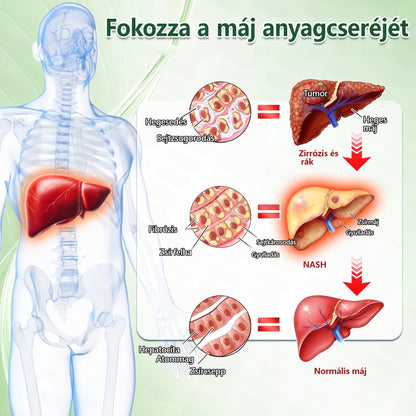 🌿Luxarise®Glumasetide 8az 1-ben Karcsu és Egeszséges Nano Mikrotus Tapasz (Napi 1alkalom – látható változásakár 7 nap alatt) ✅ Elhízásra,bőrfeszesítésre,cukorbetegségre, alvásiapnoéra, ízületekre stb HU🍀