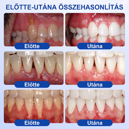🎉 𝑮𝒍𝒊𝒎𝒎𝒆𝒓𝒍𝒚® 🦷 𝑮𝒖𝒎𝑹𝒆𝒗𝒊𝒗𝒆 – gél na obnovu parodontu ❤️