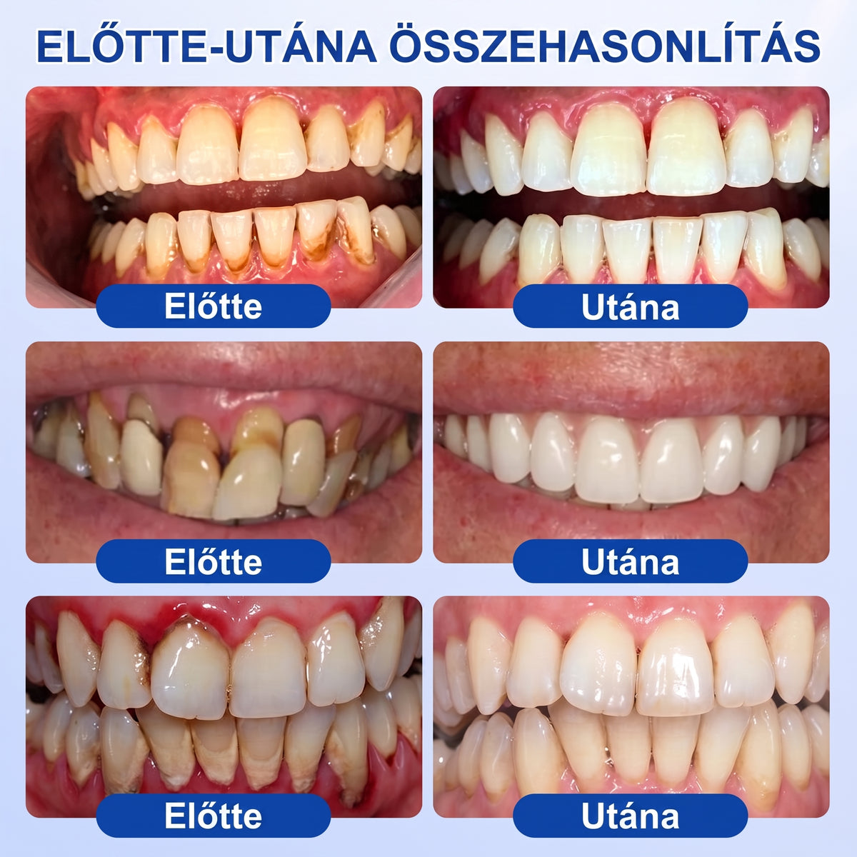 🎉 𝑮𝒍𝒊𝒎𝒎𝒆𝒓𝒍𝒚® 🦷 𝑮𝒖𝒎𝑹𝒆𝒗𝒊𝒗𝒆 – gél na obnovu parodontu ❤️
