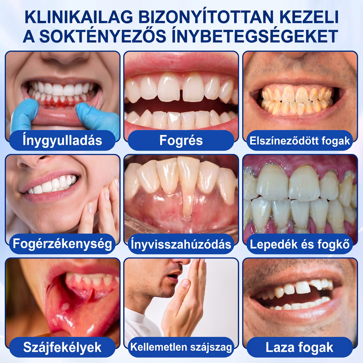 🎉 𝑮𝒍𝒊𝒎𝒎𝒆𝒓𝒍𝒚® 🦷 𝑮𝒖𝒎𝑹𝒆𝒗𝒊𝒗𝒆 – gél na obnovu parodontu ❤️