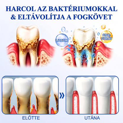 🎉 𝑮𝒍𝒊𝒎𝒎𝒆𝒓𝒍𝒚® 🦷 𝑮𝒖𝒎𝑹𝒆𝒗𝒊𝒗𝒆 – gél na obnovu parodontu ❤️