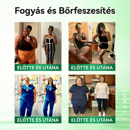 Utánvéttel fizetés [70% kedvezmény] | Magyarországon készült 🇭🇺 Florisma® 👩‍⚕️ Prémium 10 az 1-ben mikro-tűs tapasz moringával és berberinnel. Ajánlott elhízásra, cukorbetegségre, alvási apnoéra és ízületi problémákra 🌈