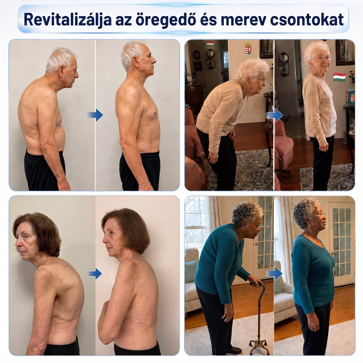 𝐏𝐢𝐜𝐝𝐨® 🧑‍⚕️ 0,05 mm-es mikrotűs csont- és ízületregeneráló görgő 🛡️ (Minden felnőtt számára, nőknek és férfiaknak egyaránt – átfogó támogatás különböző ízületi problémák esetén)✅