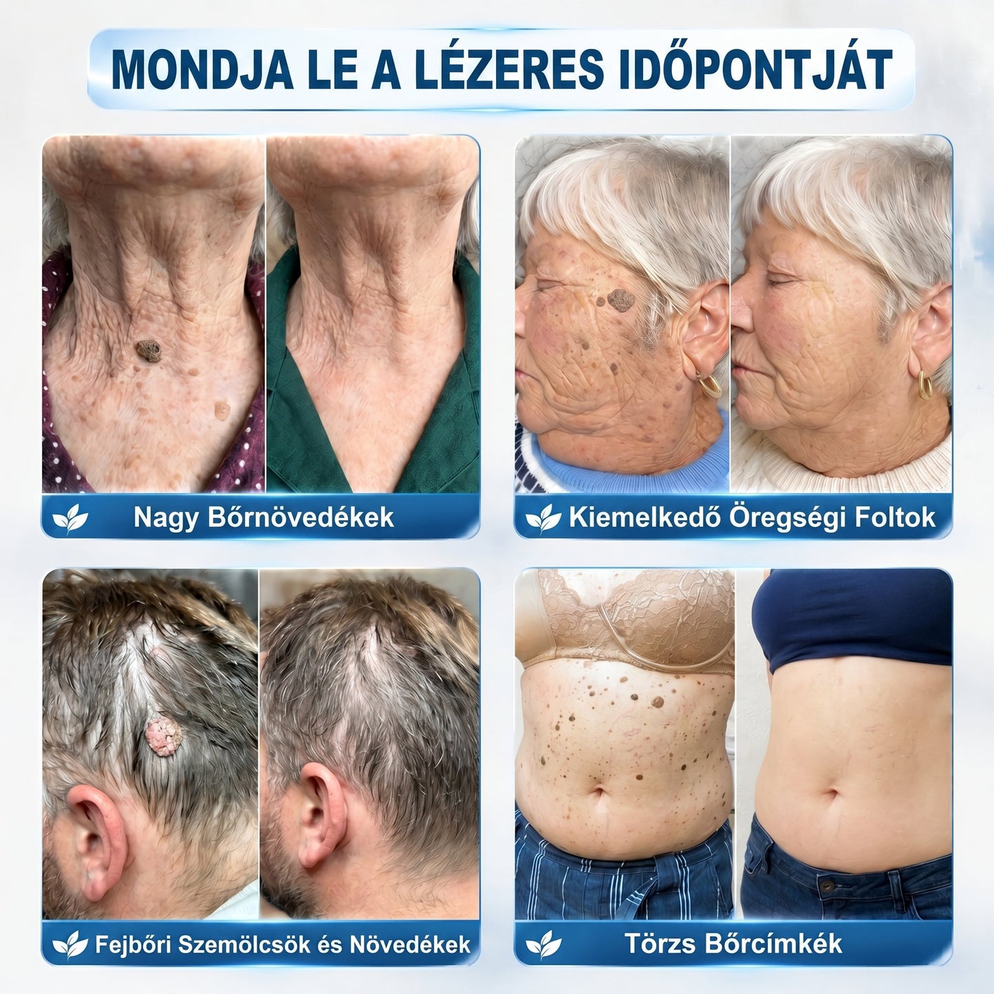🖋️💫𝐇𝐢𝐯𝐚𝐭𝐚𝐥𝐨𝐬 𝐦á𝐫𝐤𝐚𝐛𝐨𝐥𝐭  𝐏𝐢𝐜𝐝𝐨®   𝟕 𝐍𝐚𝐩𝐨𝐬 𝐁ő𝐫𝐤𝐢𝐧ö𝐯é𝐬- é𝐬 𝐅𝐨𝐥𝐭𝐫𝐚𝐝í𝐫(Fájdalommentes, nyommentes roll-on)