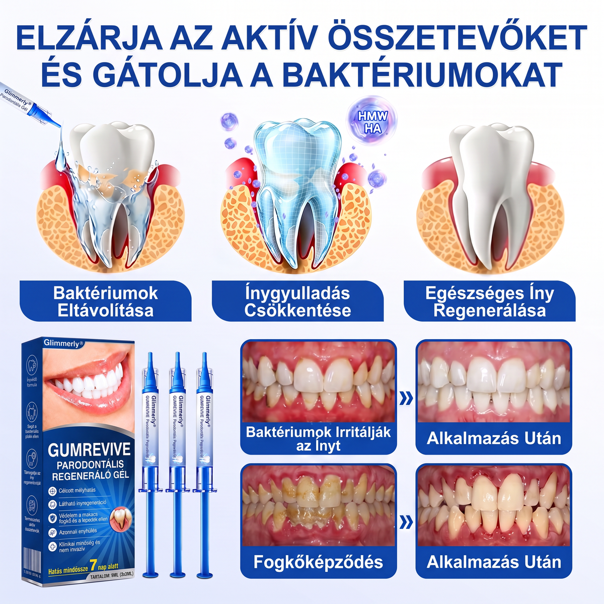 🎉 𝑮𝒍𝒊𝒎𝒎𝒆𝒓𝒍𝒚® 🦷 𝑮𝒖𝒎𝑹𝒆𝒗𝒊𝒗𝒆 – gél na obnovu parodontu ❤️