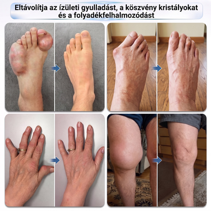 𝐏𝐢𝐜𝐝𝐨® 🧑‍⚕️ 0,05 mm-es mikrotűs csont- és ízületregeneráló görgő 🛡️ (Minden felnőtt számára, nőknek és férfiaknak egyaránt – átfogó támogatás különböző ízületi problémák esetén)✅