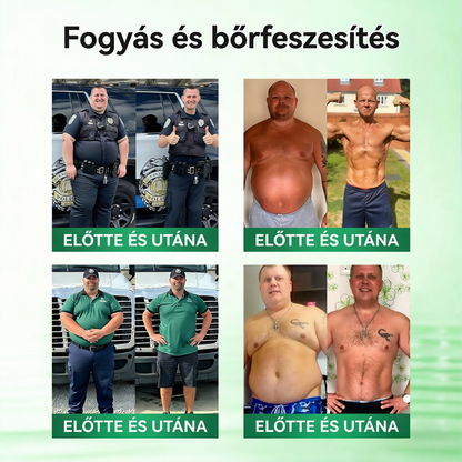 Utánvéttel fizetés [70% kedvezmény] | Magyarországon készült 🇭🇺 Florisma® 👩‍⚕️ Prémium 10 az 1-ben mikro-tűs tapasz moringával és berberinnel. Ajánlott elhízásra, cukorbetegségre, alvási apnoéra és ízületi problémákra 🌈