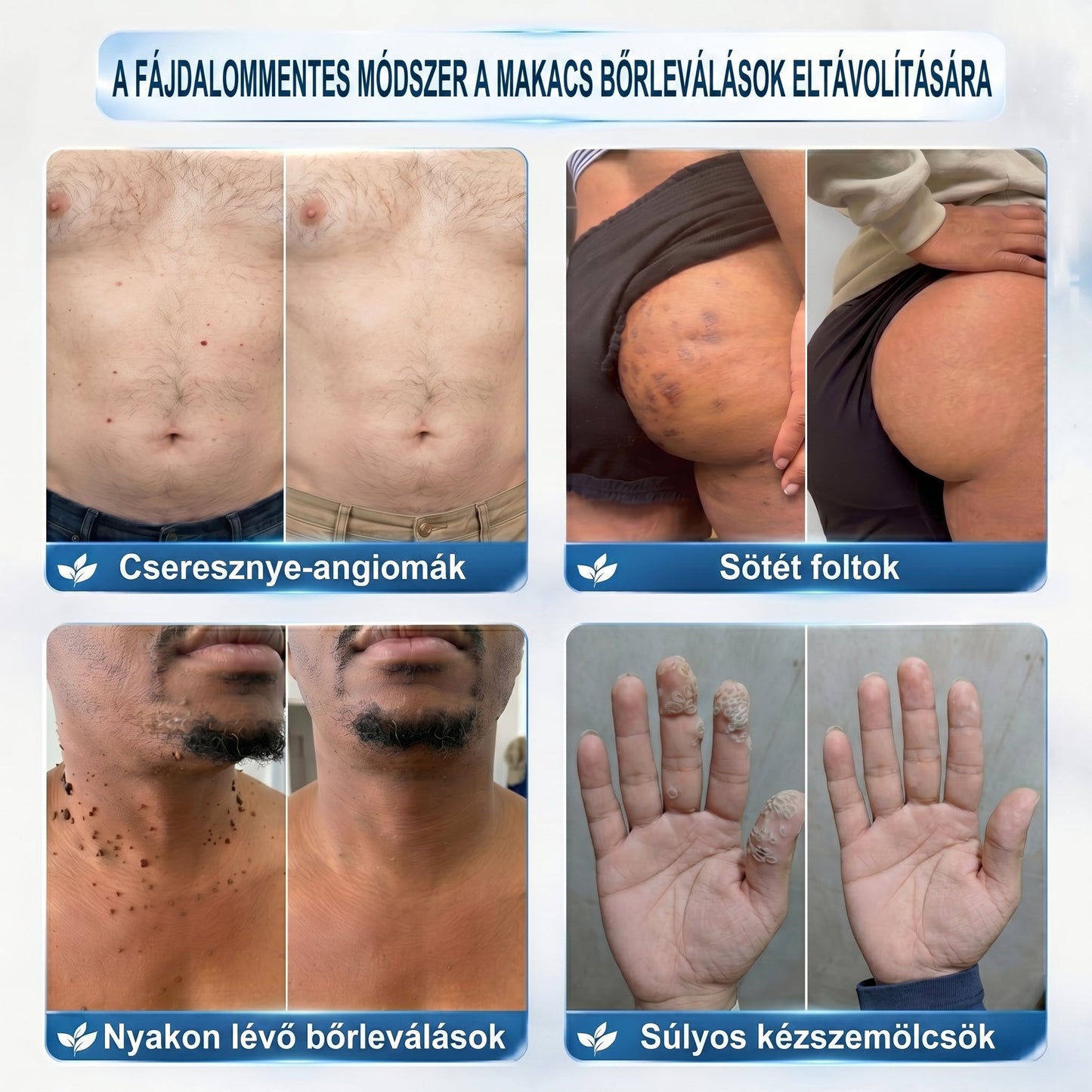 🖋️💫𝐇𝐢𝐯𝐚𝐭𝐚𝐥𝐨𝐬 𝐦á𝐫𝐤𝐚𝐛𝐨𝐥𝐭  𝐏𝐢𝐜𝐝𝐨®   𝟕 𝐍𝐚𝐩𝐨𝐬 𝐁ő𝐫𝐤𝐢𝐧ö𝐯é𝐬- é𝐬 𝐅𝐨𝐥𝐭𝐫𝐚𝐝í𝐫(Fájdalommentes, nyommentes roll-on)