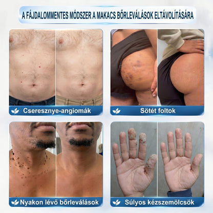 🖋️💫𝐇𝐢𝐯𝐚𝐭𝐚𝐥𝐨𝐬 𝐦á𝐫𝐤𝐚𝐛𝐨𝐥𝐭  𝐏𝐢𝐜𝐝𝐨®   𝟕 𝐍𝐚𝐩𝐨𝐬 𝐁ő𝐫𝐤𝐢𝐧ö𝐯é𝐬- é𝐬 𝐅𝐨𝐥𝐭𝐫𝐚𝐝í𝐫(Fájdalommentes, nyommentes roll-on)