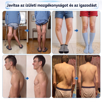 𝐏𝐢𝐜𝐝𝐨® 🧑‍⚕️ 0,05 mm-es mikrotűs csont- és ízületregeneráló görgő 🛡️ (Minden felnőtt számára, nőknek és férfiaknak egyaránt – átfogó támogatás különböző ízületi problémák esetén)✅