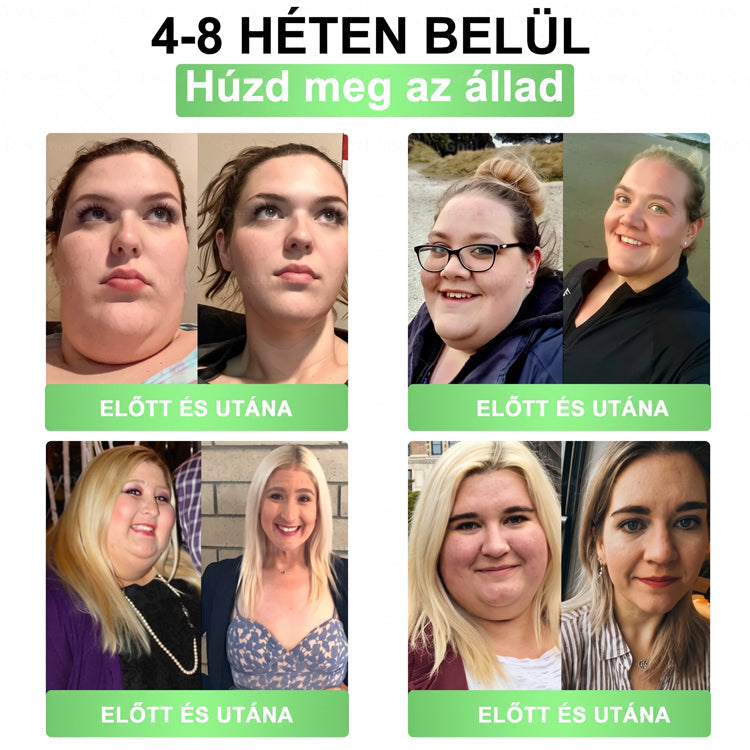 🌿Luxarise®Glumasetide 8az 1-ben Karcsu és Egeszséges Nano Mikrotus Tapasz (Napi 1alkalom – látható változásakár 7 nap alatt) ✅ Elhízásra,bőrfeszesítésre,cukorbetegségre, alvásiapnoéra, ízületekre stb HU🍀