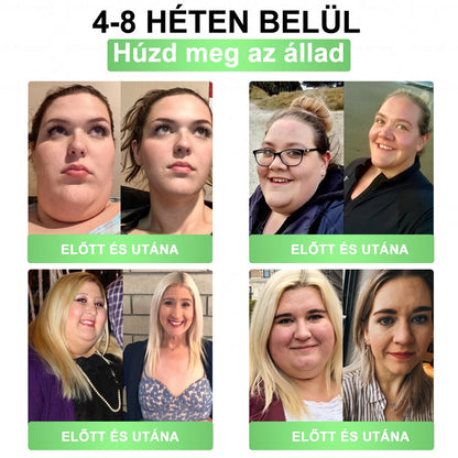 🌿Luxarise®Glumasetide 8az 1-ben Karcsu és Egeszséges Nano Mikrotus Tapasz (Napi 1alkalom – látható változásakár 7 nap alatt) ✅ Elhízásra,bőrfeszesítésre,cukorbetegségre, alvásiapnoéra, ízületekre stb HU🍀