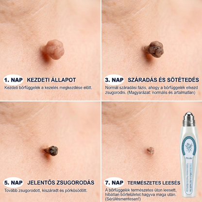 🖋️💫𝐇𝐢𝐯𝐚𝐭𝐚𝐥𝐨𝐬 𝐦á𝐫𝐤𝐚𝐛𝐨𝐥𝐭  𝐏𝐢𝐜𝐝𝐨®   𝟕 𝐍𝐚𝐩𝐨𝐬 𝐁ő𝐫𝐤𝐢𝐧ö𝐯é𝐬- é𝐬 𝐅𝐨𝐥𝐭𝐫𝐚𝐝í𝐫(Fájdalommentes, nyommentes roll-on)