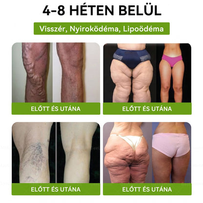🌿Luxarise®Glumasetide 8az 1-ben Karcsu és Egeszséges Nano Mikrotus Tapasz (Napi 1alkalom – látható változásakár 7 nap alatt) ✅ Elhízásra,bőrfeszesítésre,cukorbetegségre, alvásiapnoéra, ízületekre stb HU🍀